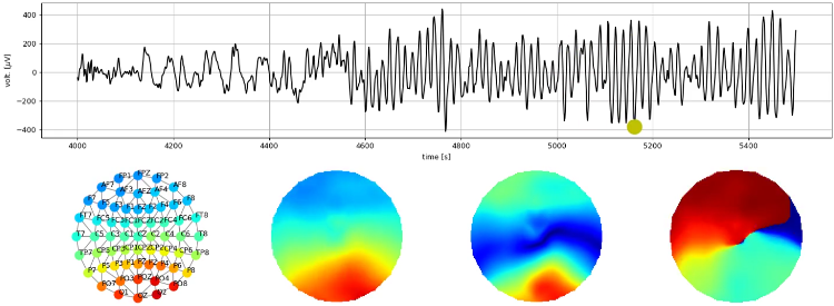 Resting-state EEG patterns